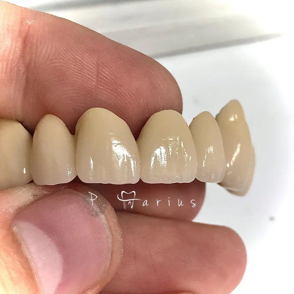 Punte din ceramică ținută între degete