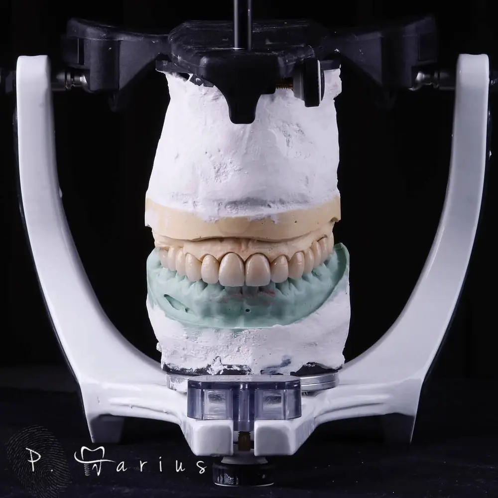 Modele dentare montate în articulator, în laboratorul Art Dent